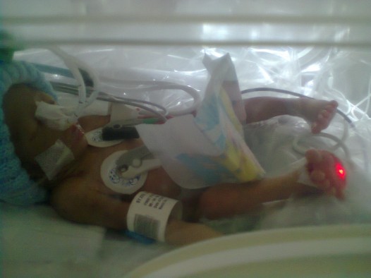 Diduga hubungan gelap, bayi dibuang, Rabu (19/11) pagi. Kini bayi tersebut masih hidup dan dirawat di RS Yos Sudarso.