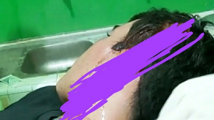 Didi Cahyadi Ningrat, pengacara dan mantan Ketua P2TP2A Kabupaten Sijunjung, dipukuli  pelaku usaha kayu di Jalan Lintas Kamang Baru-Kuantan Singingi