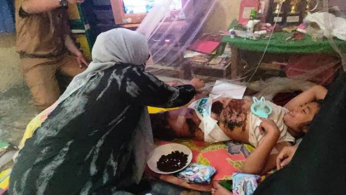 Ketua TP PKK Pasaman Barat Sifrowati Yulianto mengunjungi keluarga Marnah Daulay (50) karena anaknya Halifah di Ujung Gading tersiram minyak goreng Senin lalu