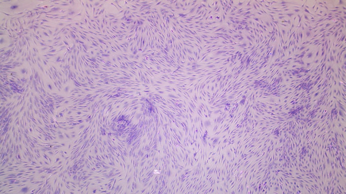 Gambar stem cell dari membran sinovial dengan perbesaran 400x yang diwarnai dengan giemsa > Dok. Marlina